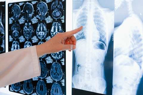 Como a IA está mudando o diagnóstico médico
